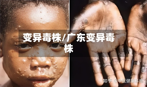 变异毒株/广东变异毒株