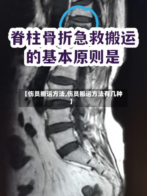 【伤员搬运方法,伤员搬运方法有几种】