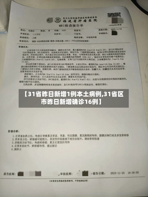 【31省昨日新增1例本土病例,31省区市昨日新增确诊16例】-第2张图片